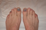 This is what feet look like after 35 miles on steep rocky trails.